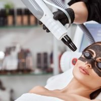 Carbon Facial (2)
